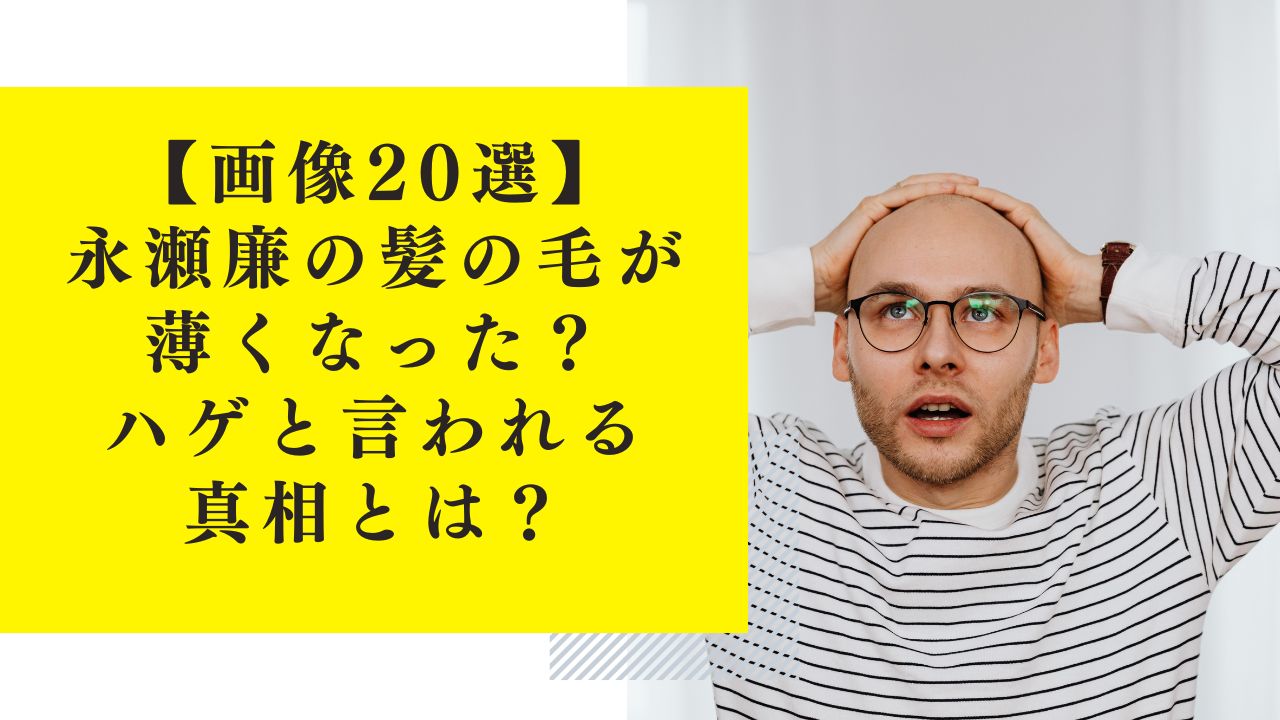 【画像20選】永瀬廉の髪の毛が薄くなった？おでこが広くてハゲと言われる真相とは？