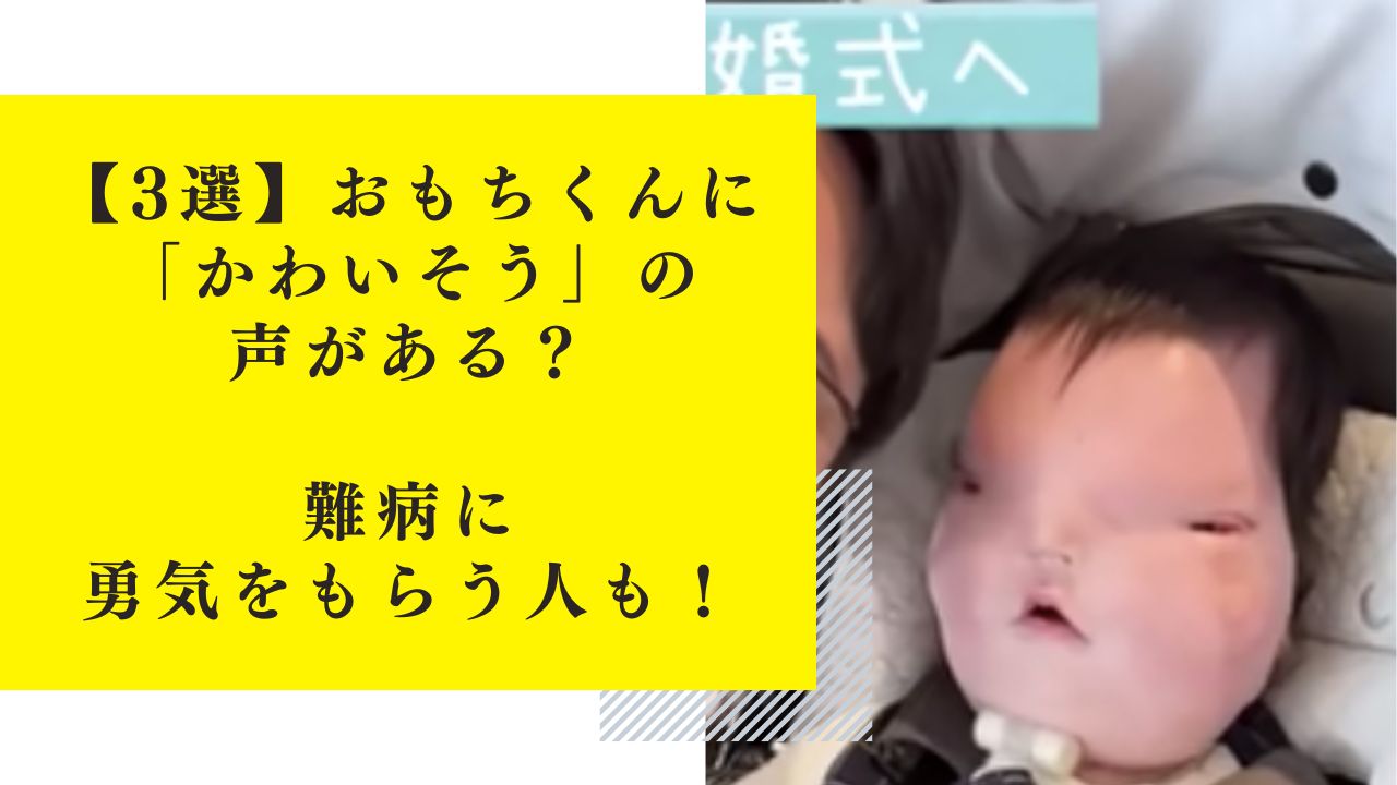 【3選】おもちくんに「かわいそう」の声がある？難病に勇気をもらう人も！